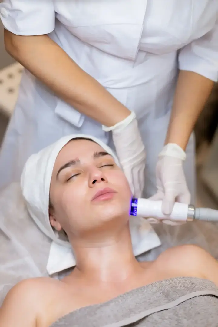Microneedling vara Bacău