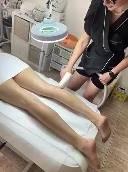 plajă după epilarea definitivă laser